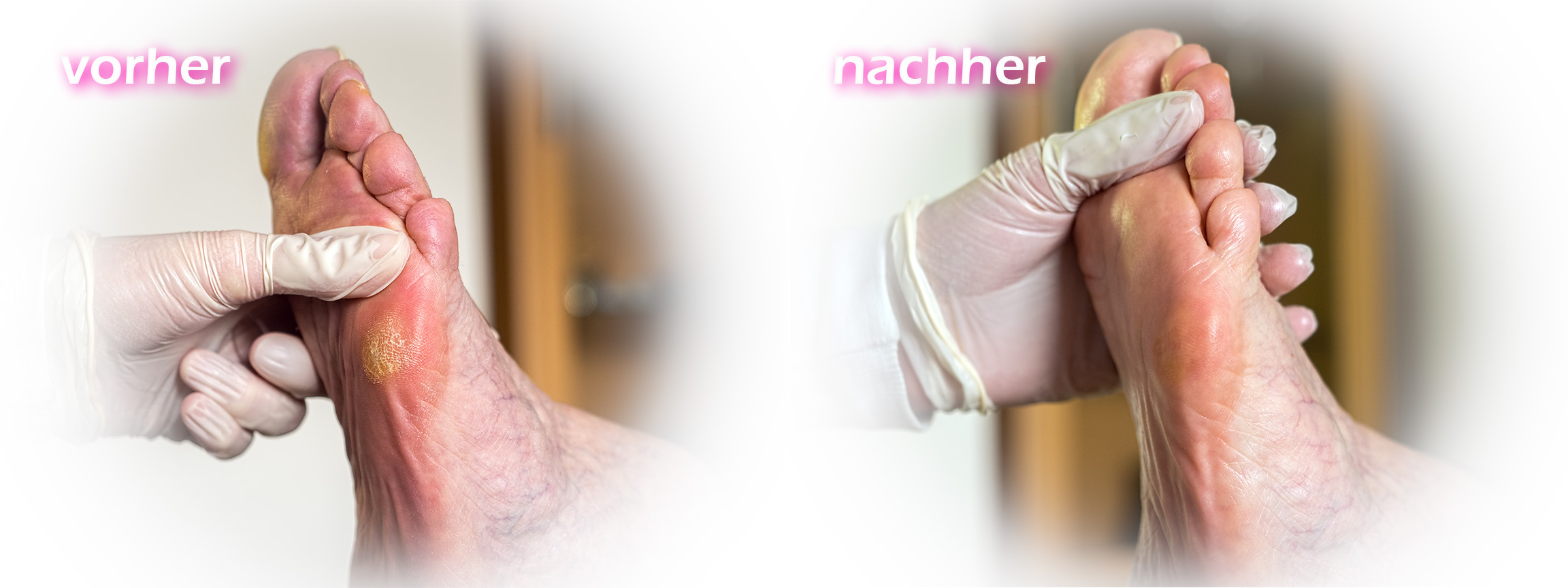 behandlung